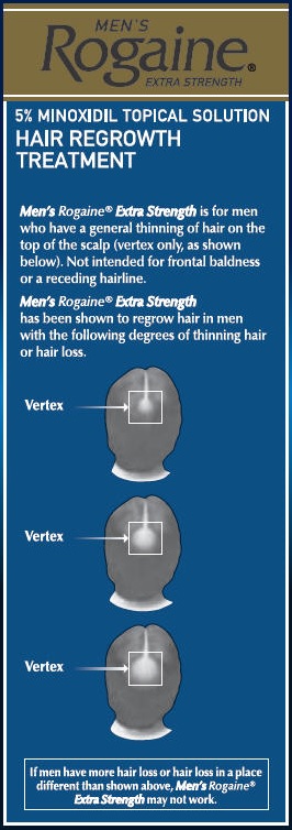 vertex.jpg