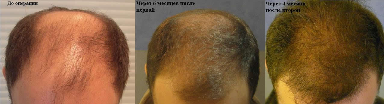 f38.jpg