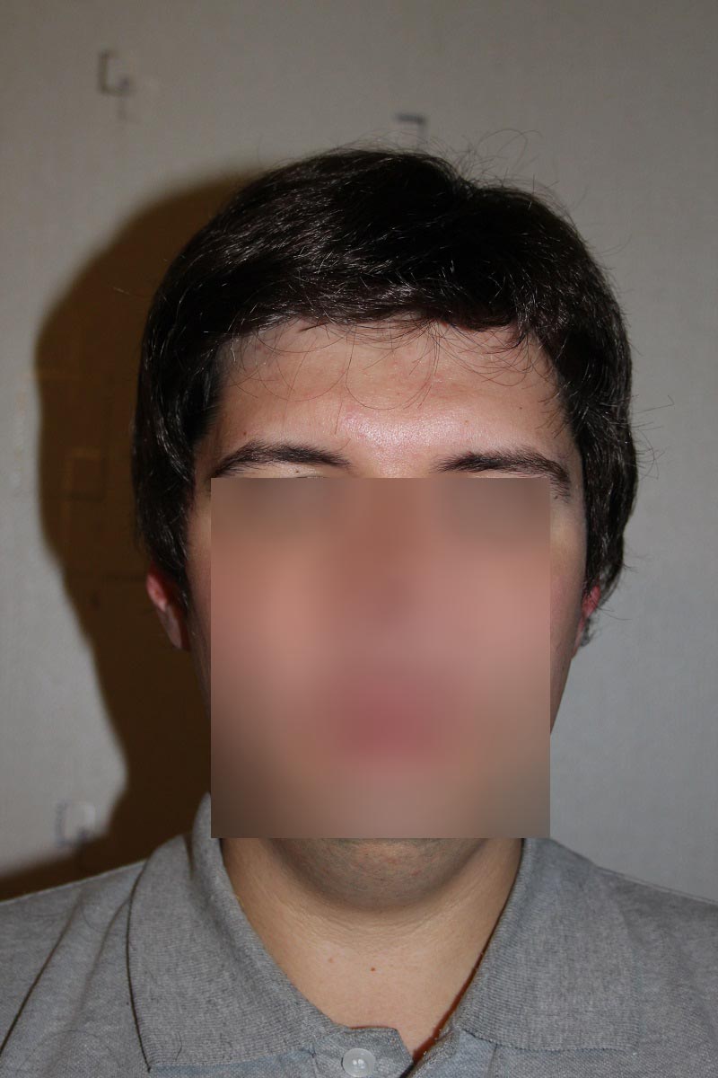 003.jpg