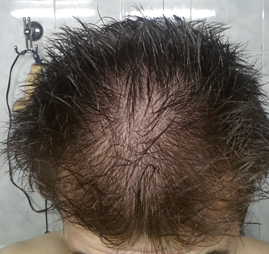 20150816_173716.jpg