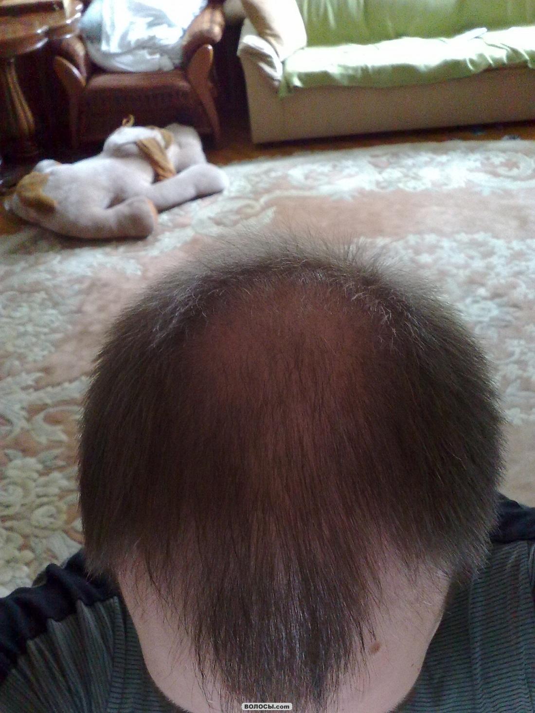 image2.jpeg